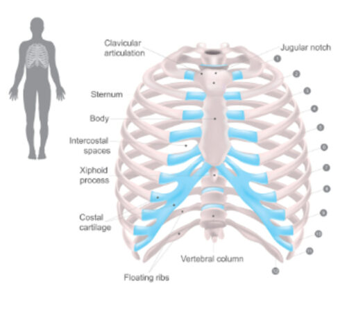 側弯症の脊柱固定術後における呼吸機能低下と胸郭アプローチの必要性