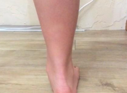 Foot Pain Holding You Back?Expert Assessment, Treatment & Custom Insoles in Tokyo